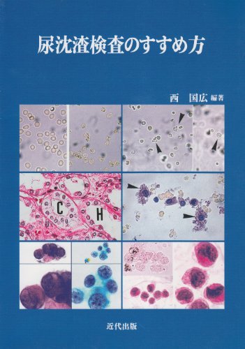 印象のデザイン 【中古】 尿沈渣検査のすすめ方 「尿沈渣検査法」の標