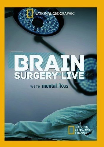 【中古】 Brain Surgery Live With Mental Floss [DVD] [輸入盤]_画像1