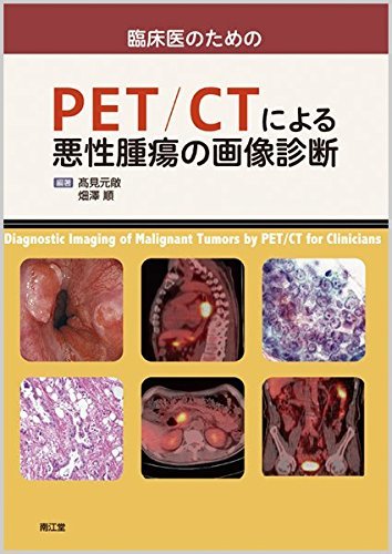 【中古】 臨床医のためのPET/CTによる悪性腫瘍の画像診断_画像1