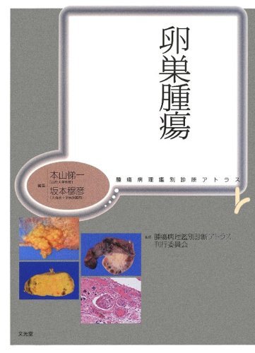 【中古】 卵巣腫瘍 腫瘍病理鑑別診断アトラス_画像1