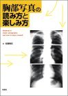 【中古】 胸部写真の読み方と楽しみ方_画像1