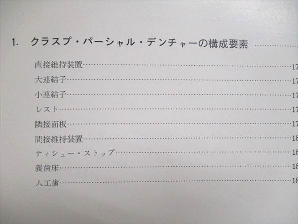 US84-076 医歯薬出版 クロール パーシャル デンチャー デザイン アイ・バー・クラスプ教本 1976 Arthur J. Krol 15S6D_画像4