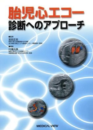 胎児心エコー診断へのアプローチ／川滝元良(著者),宝田正志(著者)_画像1