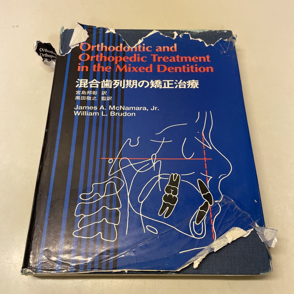 D01♪送料無料★除籍本★混合歯列期の矯正治療 宮島邦彰 黒田敬之 McNamara Brudon 東京臨床出版 1997年★230703の画像1