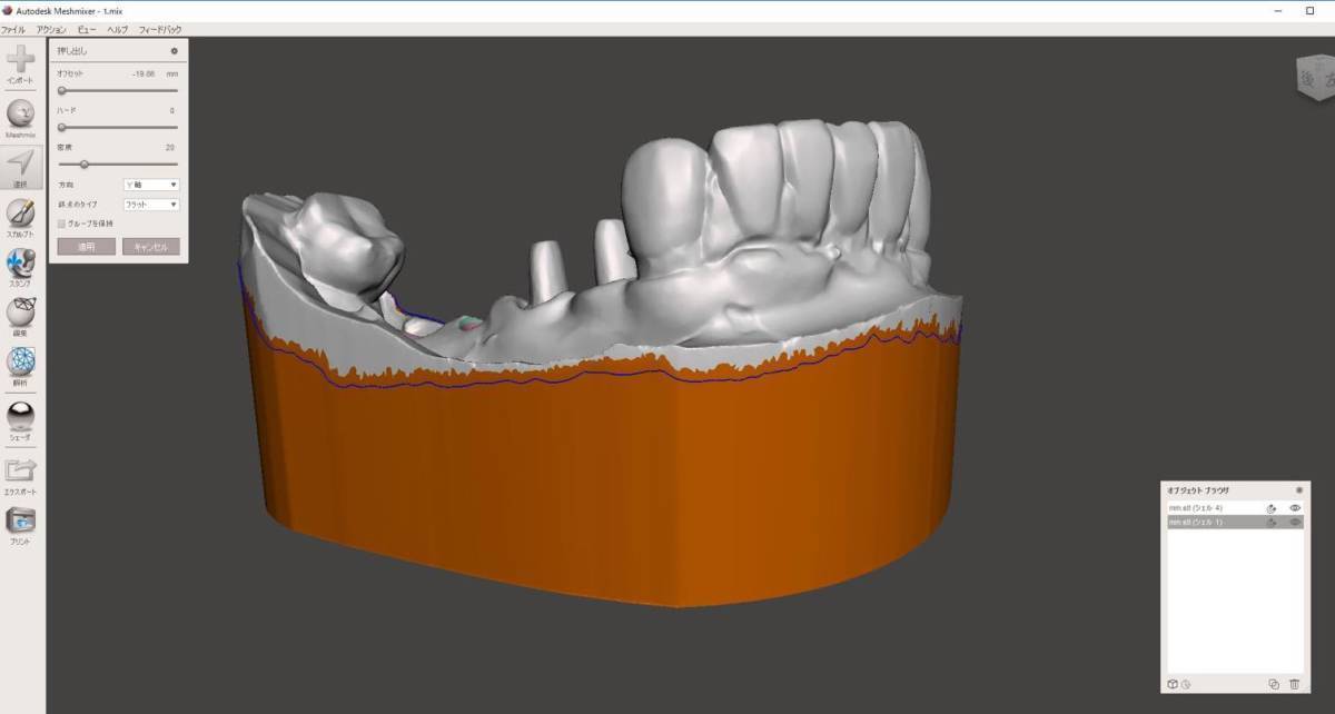 歯科 歯科技工 3Dプリントにインプラントレプリカを戻すための製作手順書 Meshmixer+Labo Scannerの画像5