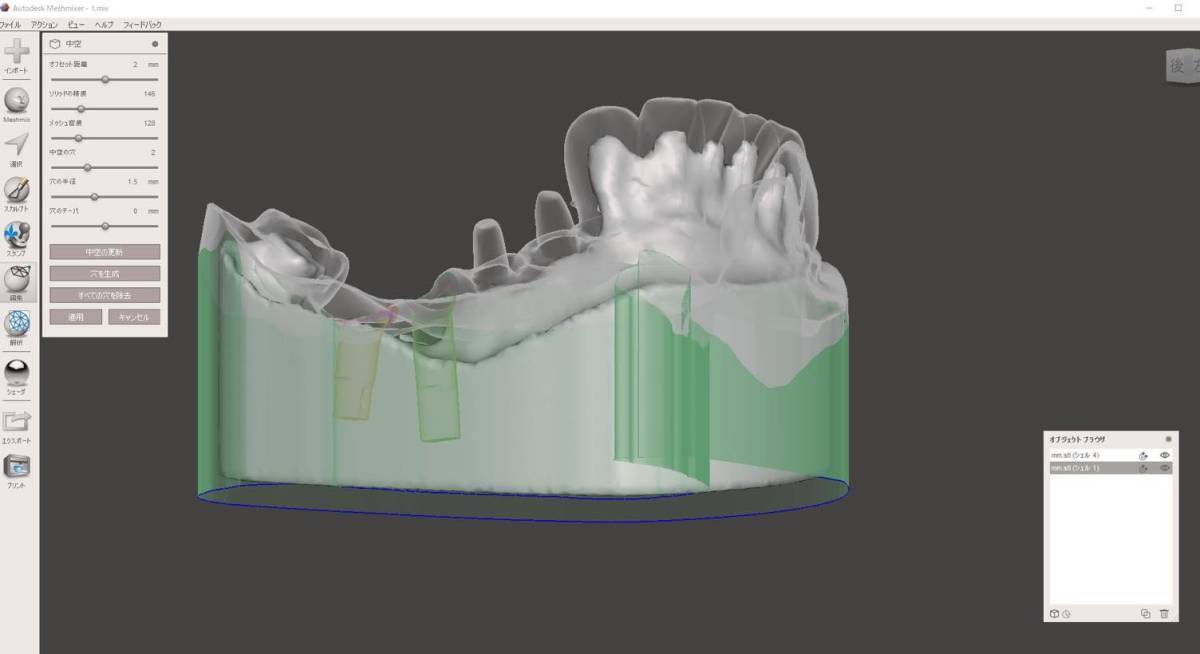 歯科 歯科技工 3Dプリントにインプラントレプリカを戻すための製作手順書 Meshmixer+Labo Scannerの画像6