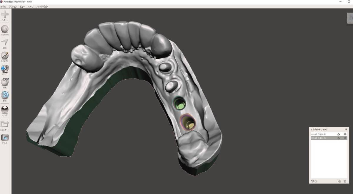 歯科 歯科技工 3Dプリントにインプラントレプリカを戻すための製作手順書 Meshmixer+Labo Scannerの画像8