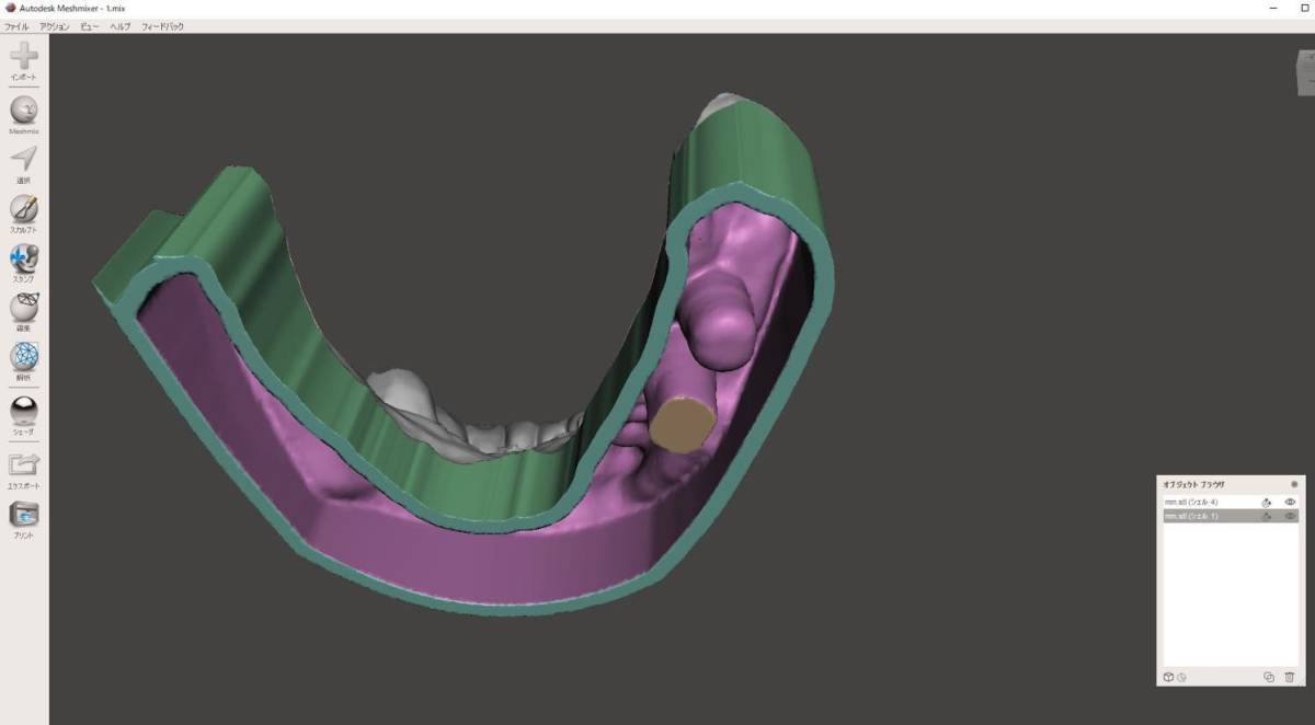 歯科 歯科技工 3Dプリントにインプラントレプリカを戻すための製作手順書 Meshmixer+Labo Scannerの画像7