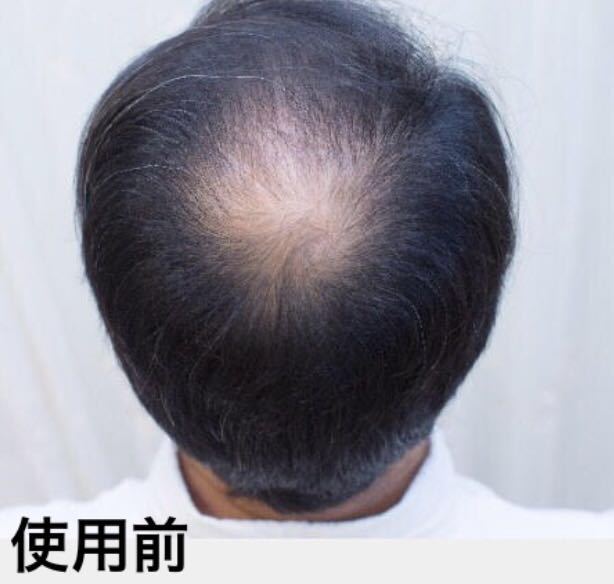 薄毛増毛ヘアーパウダー噴霧式ボトルタイプ：ダークブラウン：日本製プロ用ふりかけ禿げつむじ白髪隠しボリュームアップファンデーション2