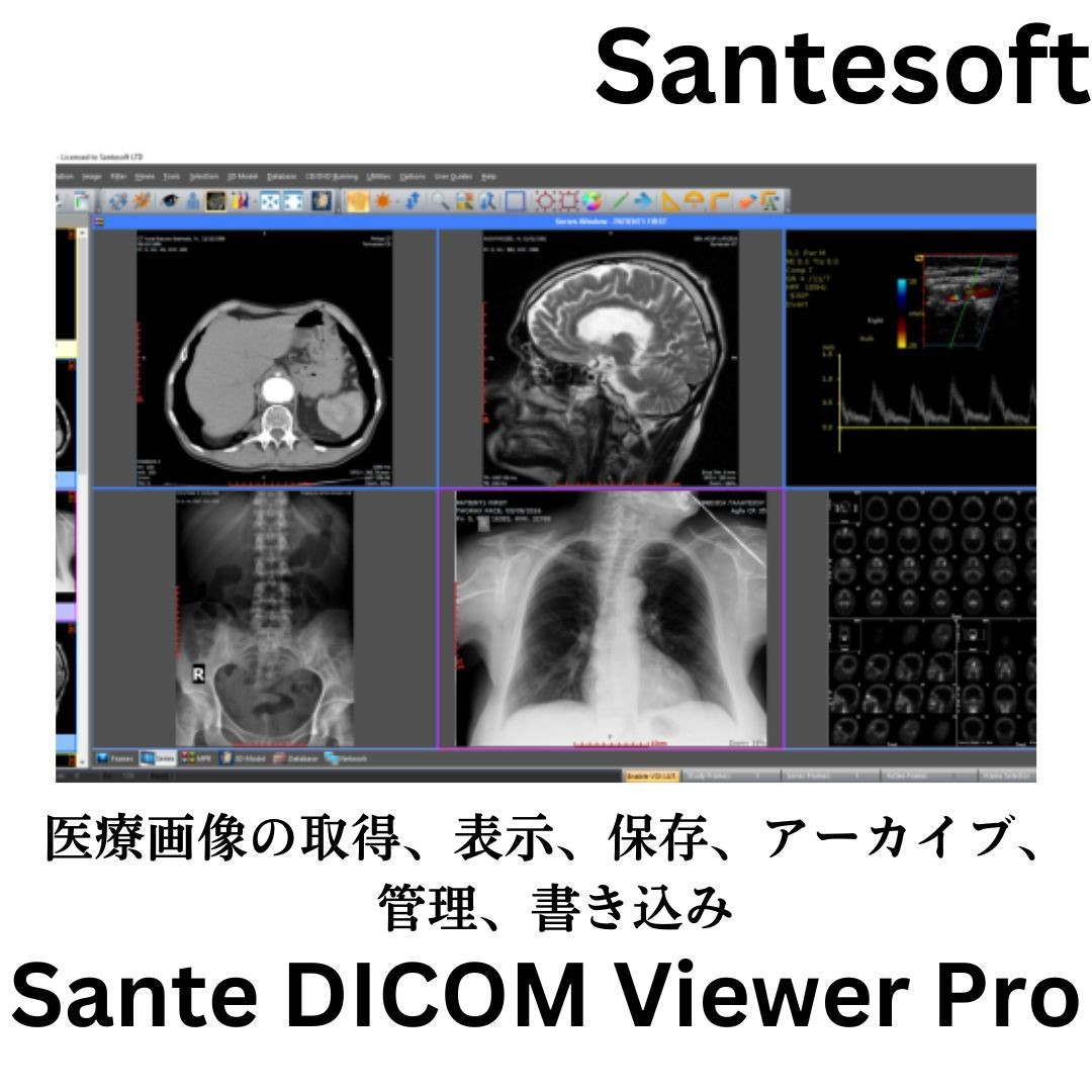 最も完璧な 2D/3D 2023 Pro Viewer DICOM Sante DICOM C-GET SCU/SCP C