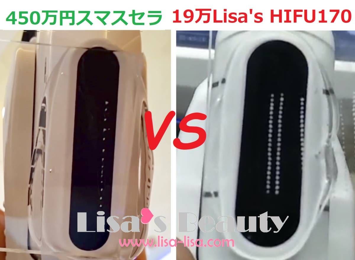スマート進化版】HIFU 最新型ハイフ☆切らないフェイスリフト+ スマート進化版】HIFU 最新型ハイフ☆切らないフェイスリフト+