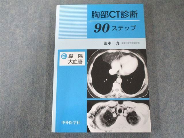 UW81-048 中外医学社 胸部CT診断90ステップ 2―縦隔・大血管 状態良い 2014 12m3C_画像1