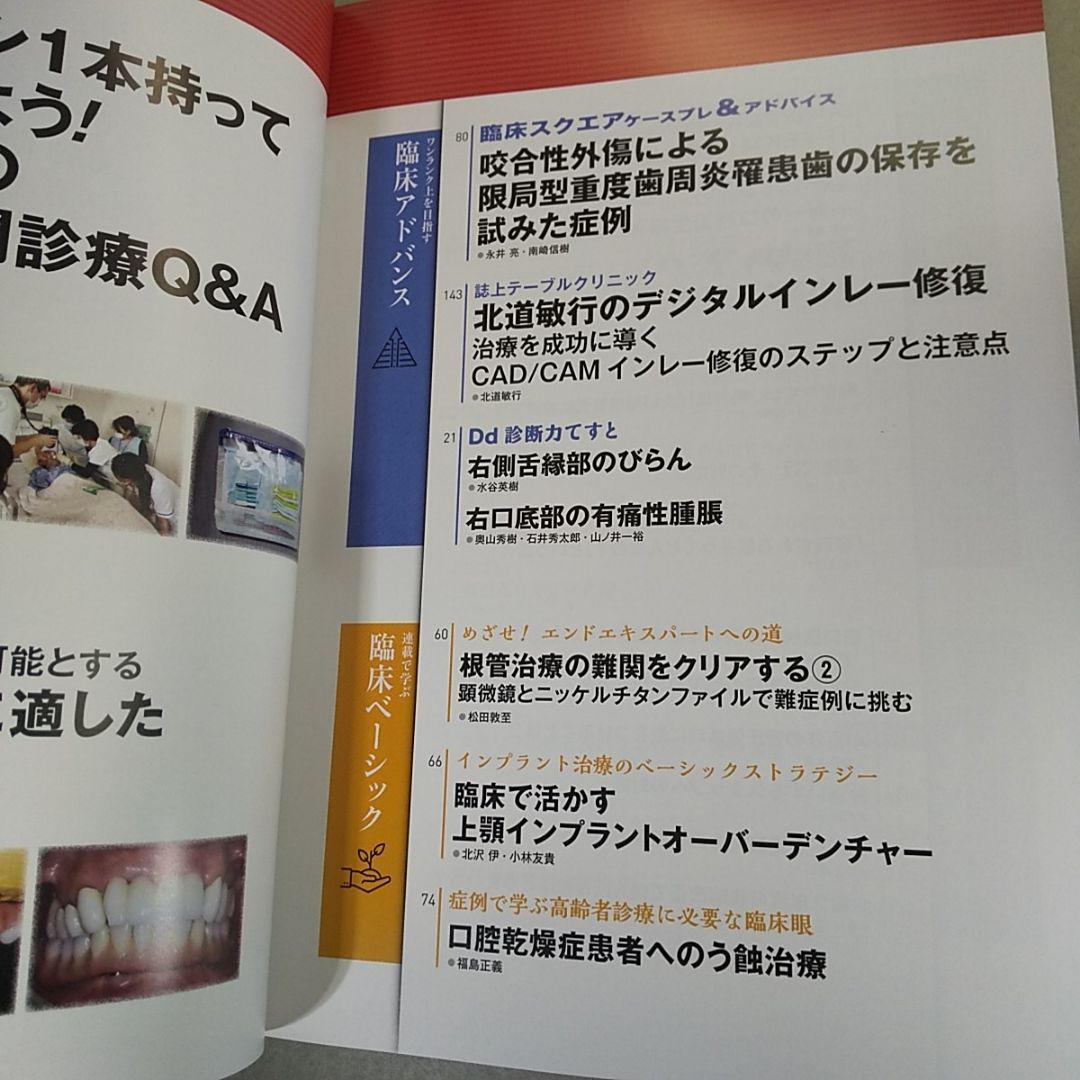 デンタルダイヤモンド　2020年5月号 初めての歯科訪問診療Q＆A_画像3