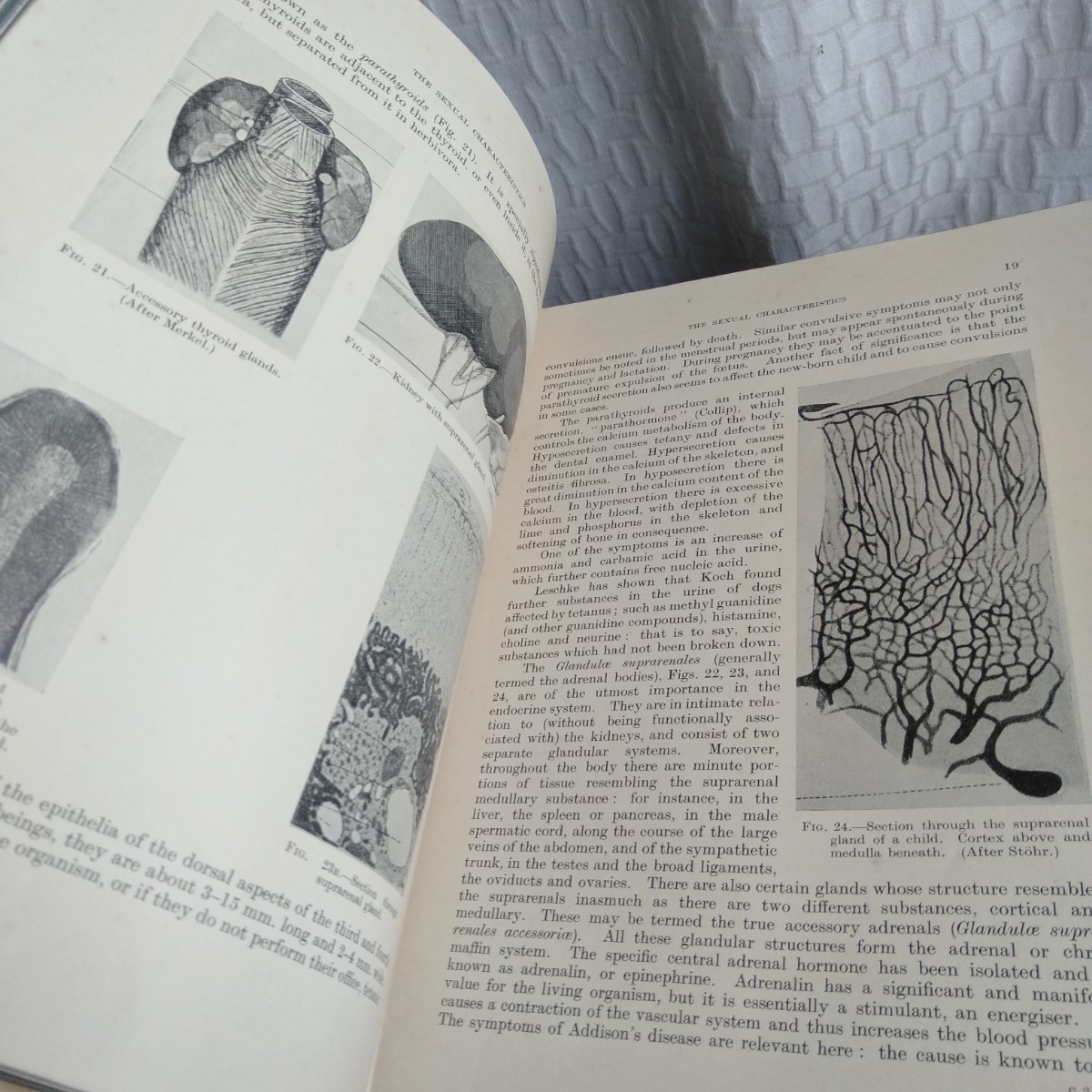 Y014 古書 WOMAN(女性) プロス・バルテル 1935年 3冊まとめて Y014 古書 WOMAN(女性) プロス・バルテル 1935年 3冊まとめて
