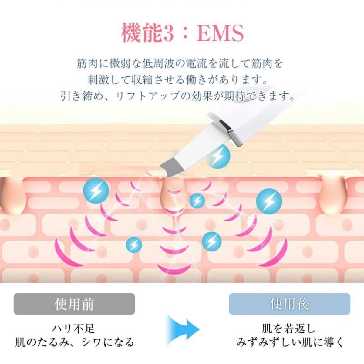 美顔器 ウォーターピーリング EMS 毛穴洗浄  イオンクリーナー 超音波振動 超音波美顔器 黒ずみ 毛穴吸引器 美顔器 超音波