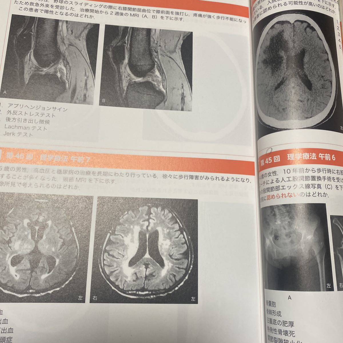 ＰＴ・ＯＴ基礎から学ぶ画像の読み方　国試画像問題攻略 （第２版） 中島雅美／編著　中島喜代彦／編著　大村優慈／編著