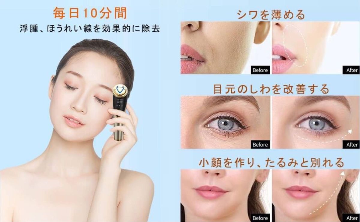 RF温冷美顔器 EMS 超音波振動 LED搭載 毛穴汚れとり 肌引き締め 目元ケア 肌ケア 男女兼用