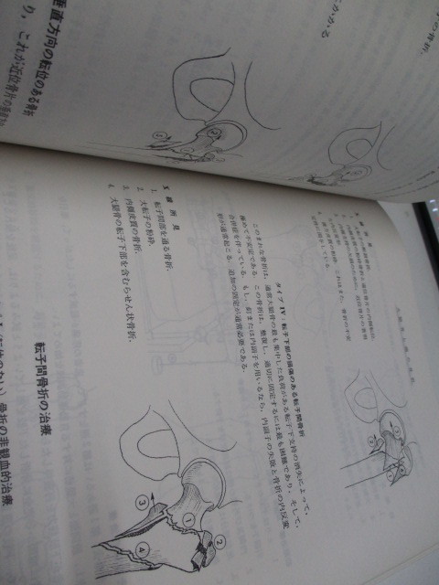 即決　病院払下げ本　図説骨折・脱臼の管理〈2〉 阿部 光俊_画像5