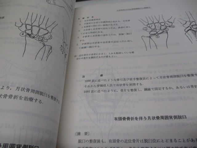 即決　病院払下げ本　図説骨折・脱臼の管理〈2〉 阿部 光俊_画像3