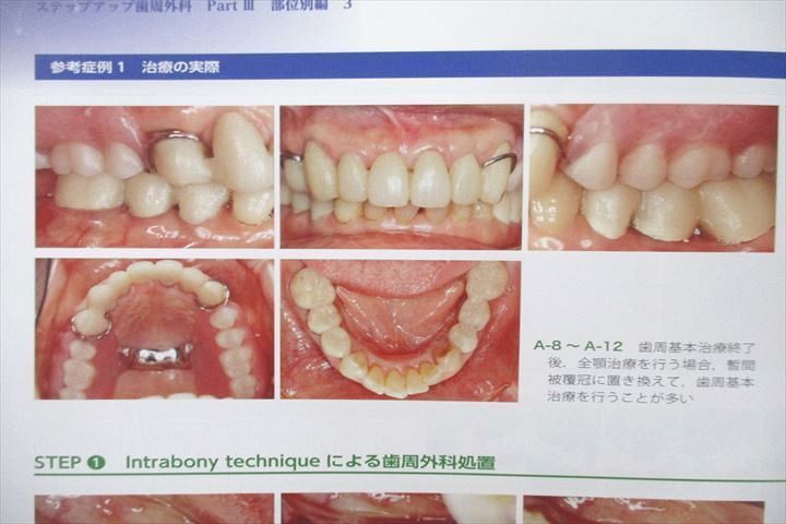 VD27-002 医歯薬出版 歯界展望 2019年1月～2022年12月 大量セット 状態良 計48冊 ★ 00L3D_画像10