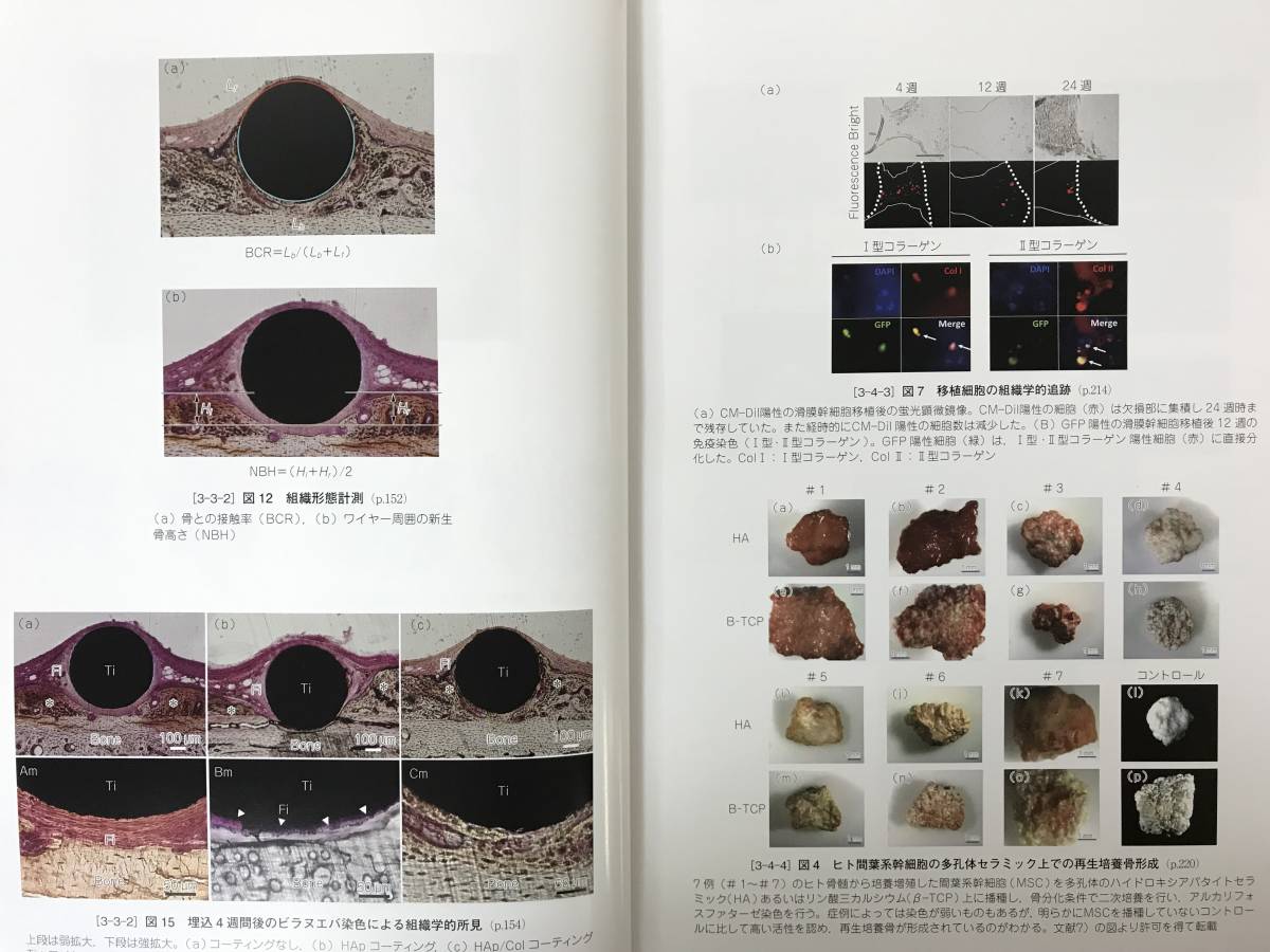 x68○アンチ・エイジングシリーズ 骨研究最前線 代謝 疾病の x68○アンチ・エイジングシリーズ 骨研究最前線 代謝 疾病の