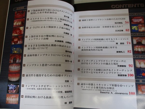 別冊 Quintessence DENTAL Implantology 究極のインプラント治療への挑戦 4thミーティング 抄録集 2006_画像4