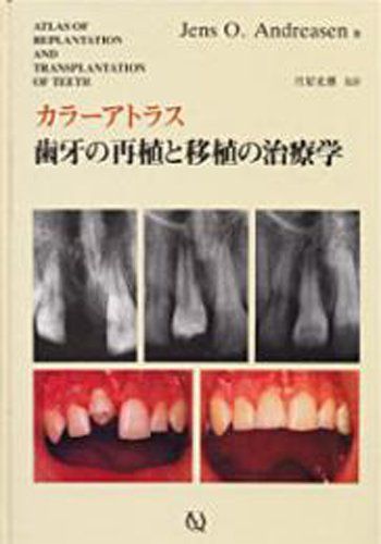 [A01508895]歯牙の再植と移植の治療学―カラーアトラス 月星 光博