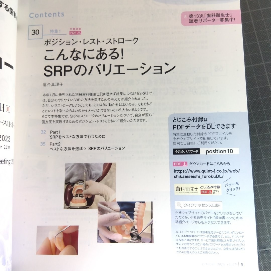 歯科衛生士　2023年10月号　こんなにある！SRPのバリエーションホワイトニングを取り入れたメインテナンス_画像2