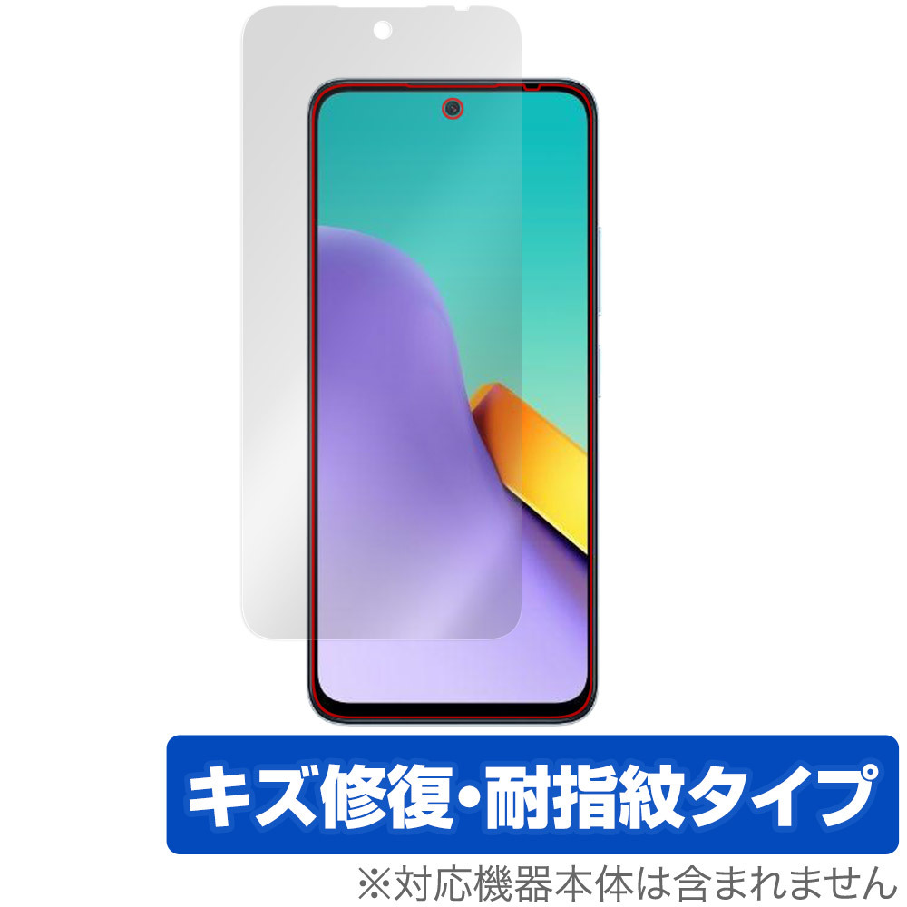Xiaomi Redmi 12 5G 保護 フィルム OverLay Magic シャオミー レドミ 12 スマホ用保護フィルム 液晶保護 傷修復 耐指紋 指紋防止_画像1