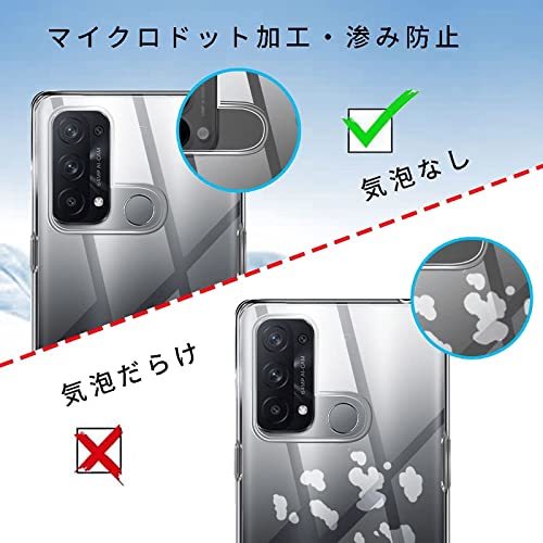 【UNEED】OPPO Reno5 A 用の スマホケース oppo reno5 a用の カバー TPU 超薄型 全面保・・・_画像4