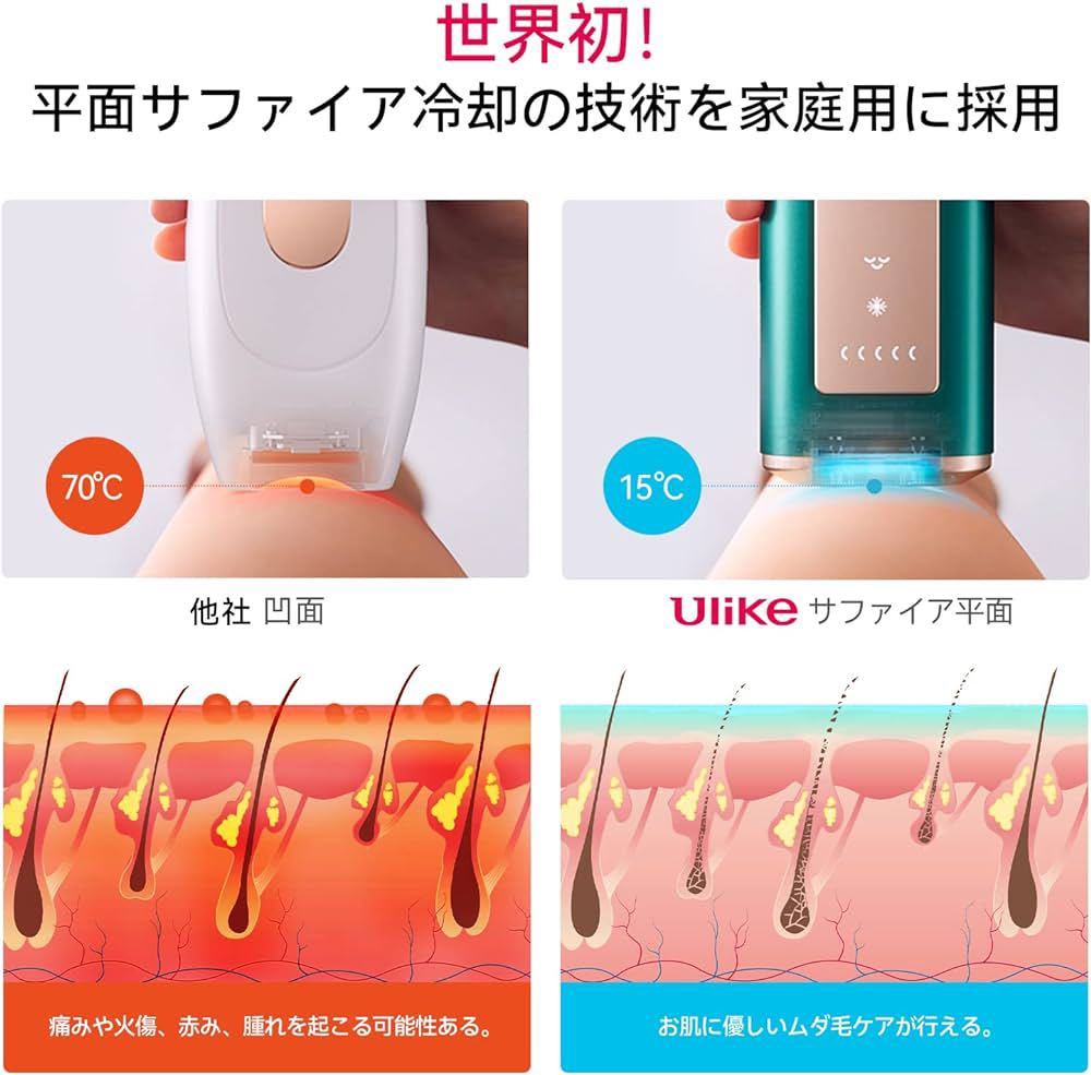 Air Pro IPL光美容器 脱毛器 メンズ レディース VIO対応 髭 腕など 照射回数65万 無痛 脱毛 だつもうき脱毛器 サロン級 ムダ毛ケア