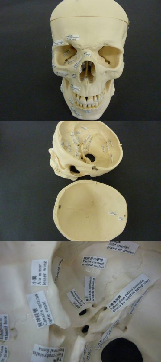 R607　保管品　坂本モデル　成人骨格分離模型　ケース付き　人体模型 全身骨格模型 骸骨模型 人骨模型 全身模型　医療　医学　_画像2