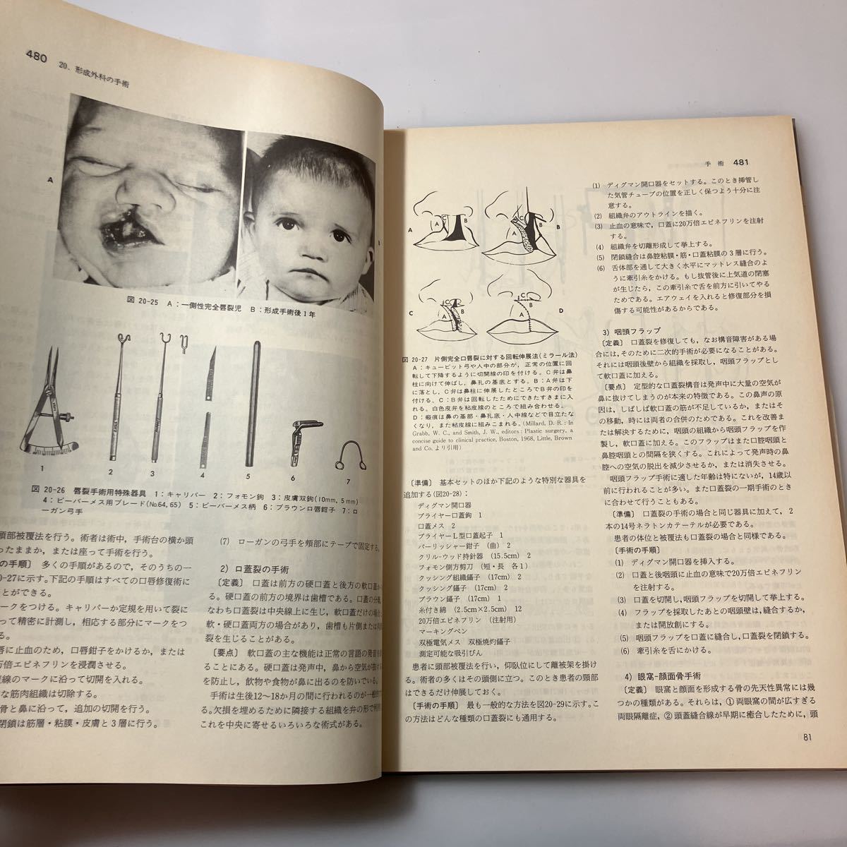 zaa-516 手術看護学 2 (新臨床看護学大系) 大型本 1985/4/1 M J zaa-516 手術看護学 2 (新臨床看護学大系) 大型本 1985/4/1 M J