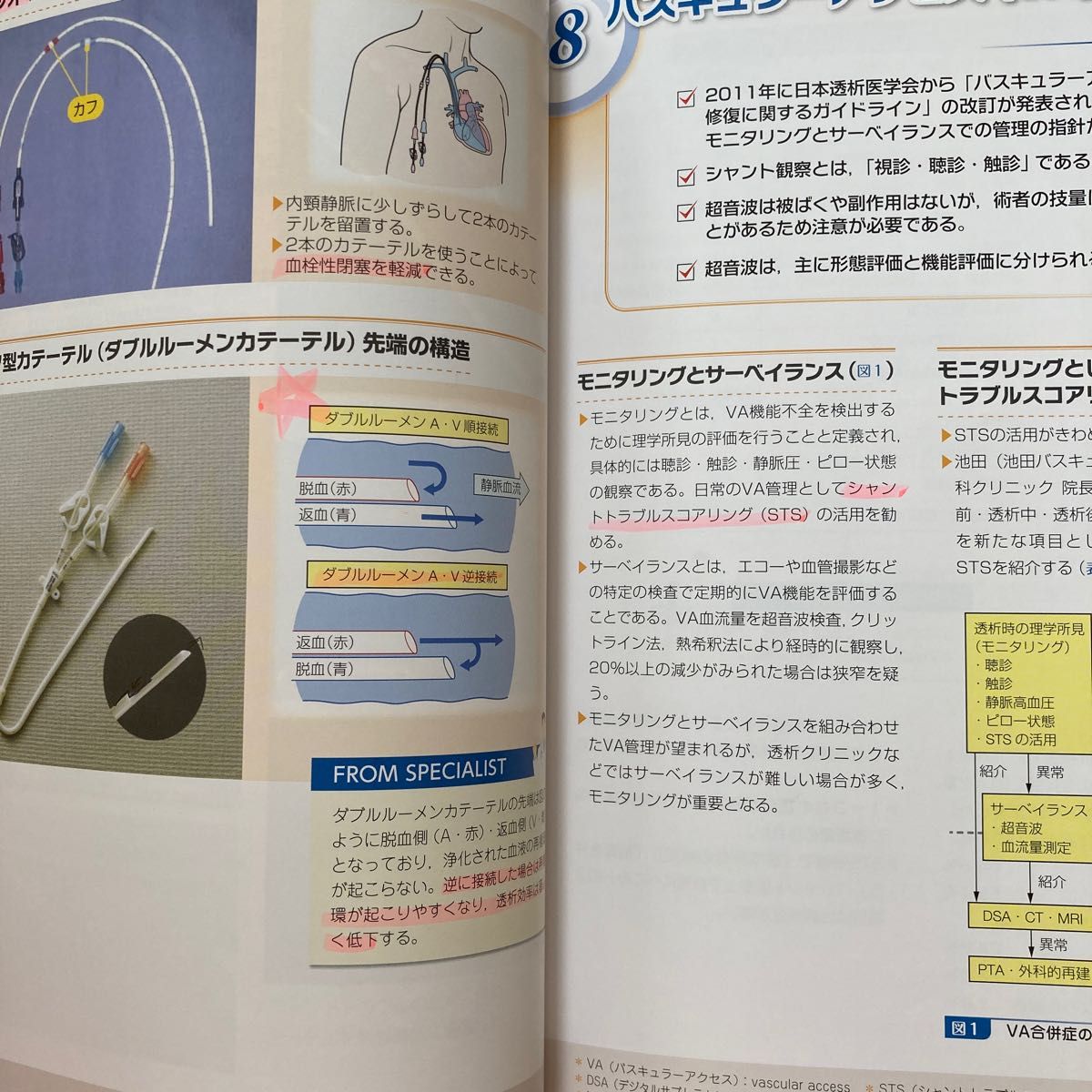 穿刺技術向上に役立つ透析スタッフのためのバスキュラーアクセスガイドブック （穿刺技術向上に役立つ） 