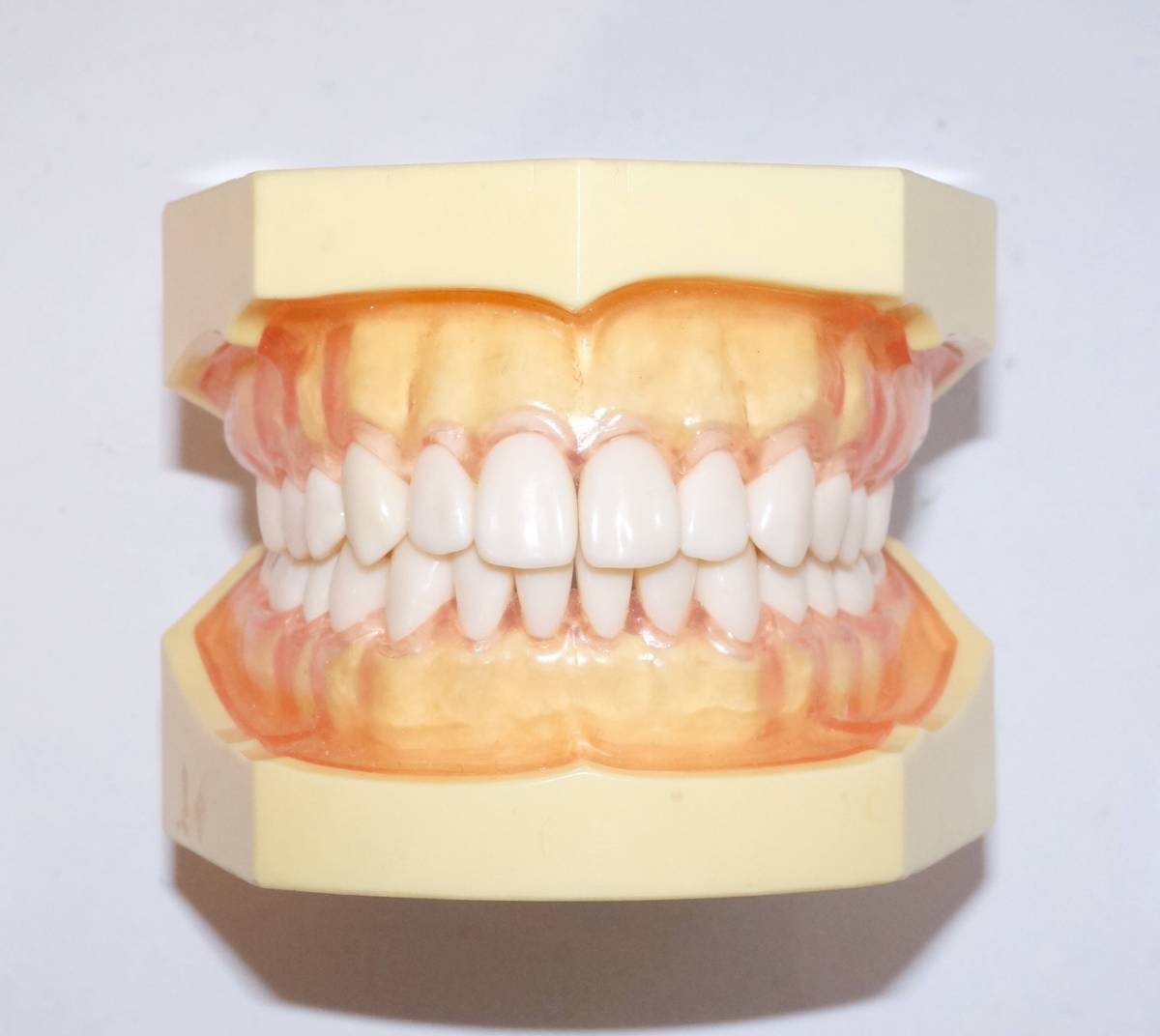 NISSIN 歯周病 歯科 模型 歯周外科 顎模型 歯科衛生士 ニッシン スケーリング スケーラー SRP 歯肉 歯石 マネキン 超音波 ペリオ 舌 _画像3