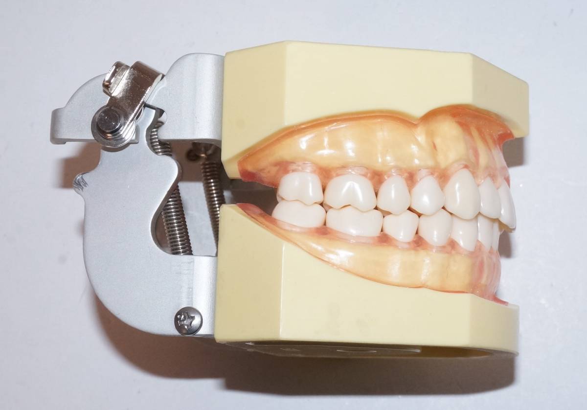 NISSIN 歯周病 歯科 模型 歯周外科 顎模型 歯科衛生士 ニッシン スケーリング スケーラー SRP 歯肉 歯石 マネキン 超音波 ペリオ 舌 _画像4