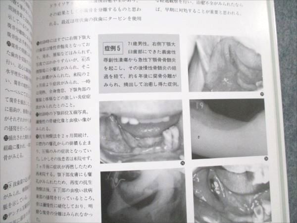 VE21-007 日本医療文化センター 修得できる口腔小手術 1988 18S6C_画像5