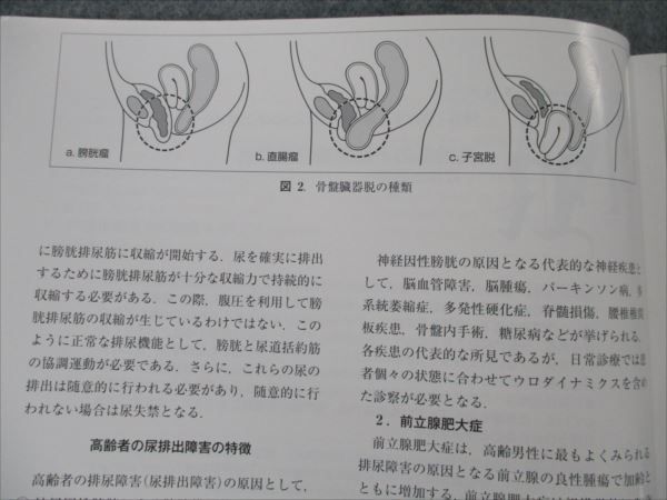 VG20-101 全日本病院出版会 MonthlyBook MEDICAL REHABILITATION 2019年3月 No.233 05s3B_画像4