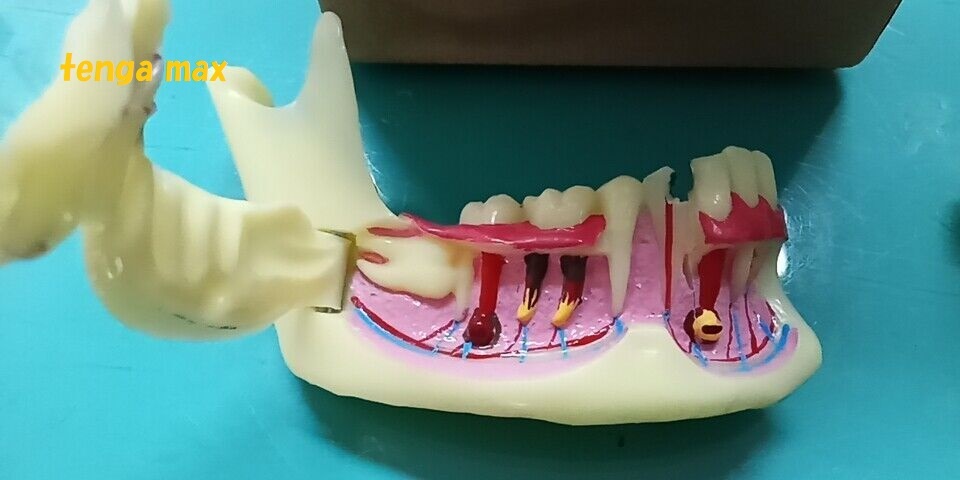 対策価格 ■ 病院 大学 教材 歯形 完成品 歯科医 歯内 療法 モデル 歯茎 ■ 解剖学 歯科研究 歯のモデルを教える教材 685_画像3