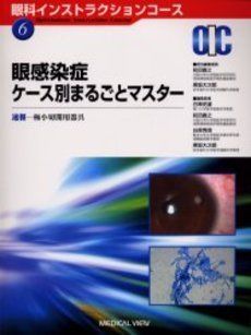 [A11095900]眼感染症ケース別まるごとマスター―速報-極小切開用器具 (眼科インストラクションコース (6))