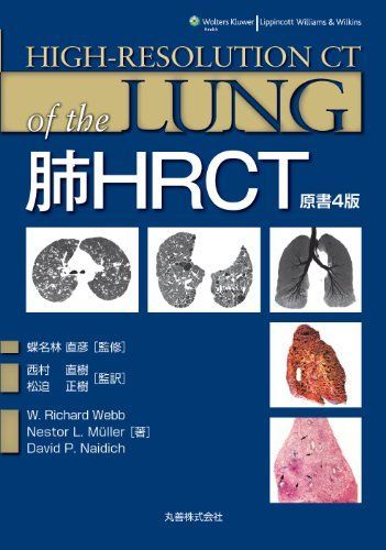 [A01255753]肺HRCT W.Richard Webb、 Nestor L. Muller、 David P. Naidich; 蝶名林 直彦_画像1