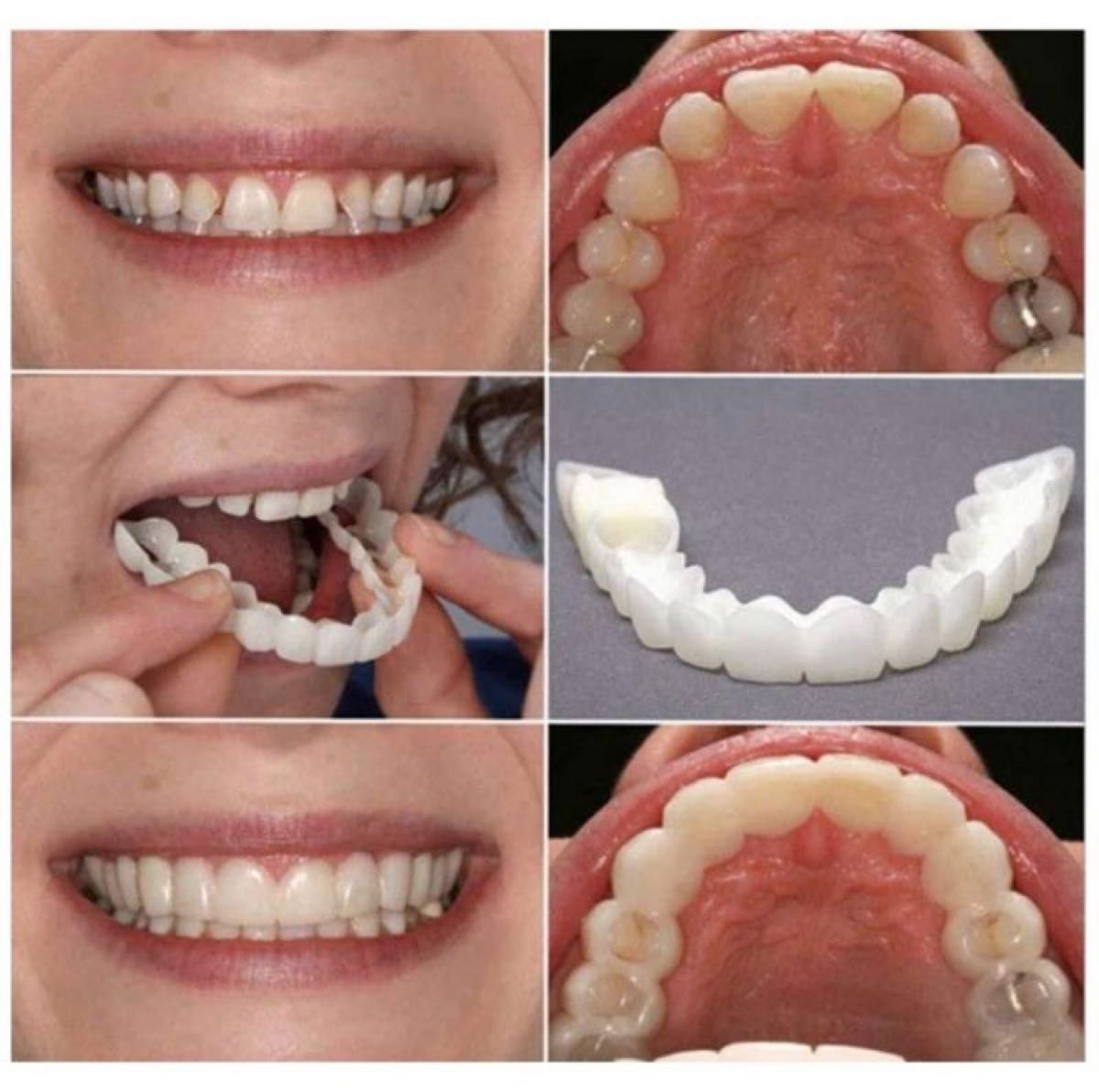マウスピース つけ歯 付け歯 入れ歯 矯正 ホワイトニング 上下セット 義歯 歯