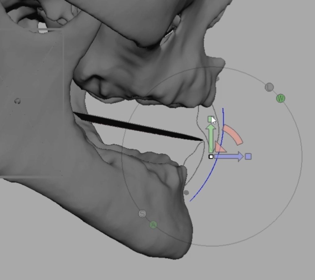 歯科 歯科技工 3D骨データ上の仮想咬合平面設定方法 mp4動画 テンプレート セファロの画像5