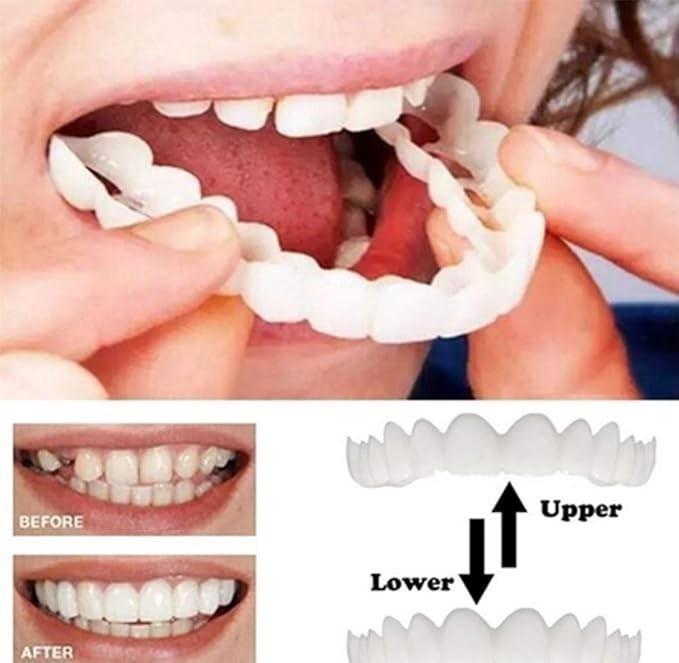 上歯下歯シミュレーションブレースホワイトニングセット第2世代シリカゲルシミュレーション歯義歯　②_画像3