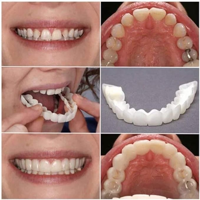 上歯下歯シミュレーションブレースホワイトニングセット第2世代シリカゲルシミュレーション歯義歯　②_画像5