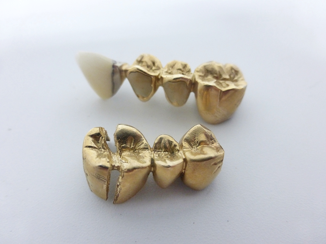 10 28-580495-28 [Y] 金歯 歯科金属 被せ物 入れ歯 オーラルケア 総重量約17.63g まとめて 名28_画像4
