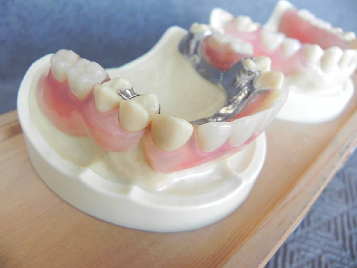 中古　＊ 歯型　模型　　廃業歯科医整理品　　_画像5