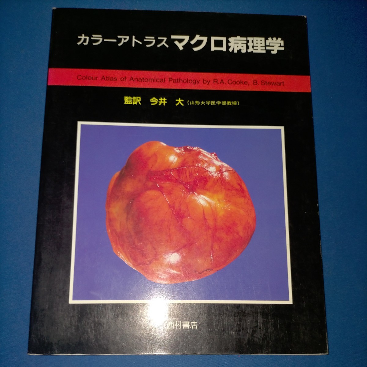 カラーアトラス マクロ病理学 西村書店