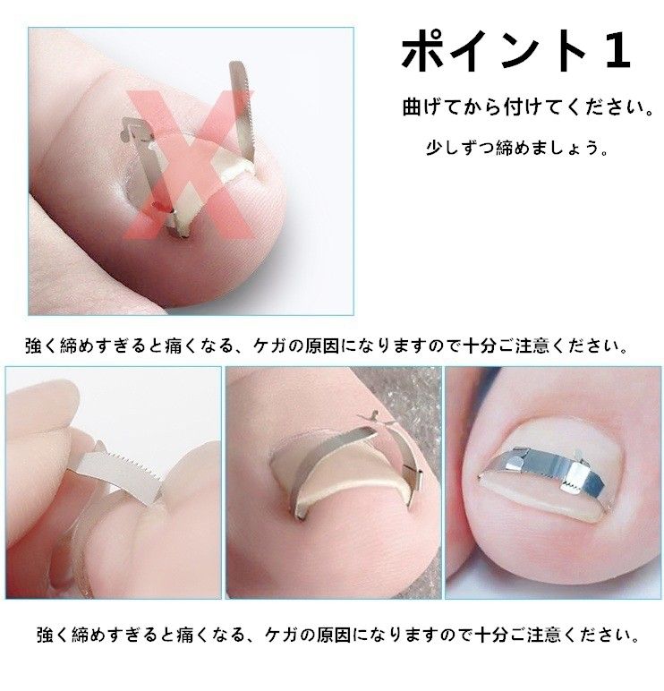 外反母趾サポーター　巻爪 まきづめ 弯曲爪 陥入爪 対策 治療 修復 改善 フットケア 親指 足指 痛み