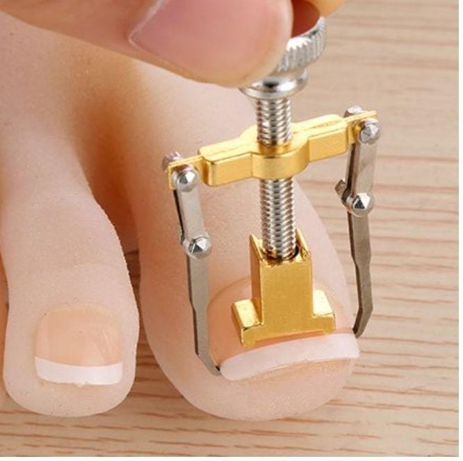  special price! safe anonymity delivery! to coil nail . worried. person worth seeing! to coil nail correction apparatus . go in nail Robot lift up volume nail correction!